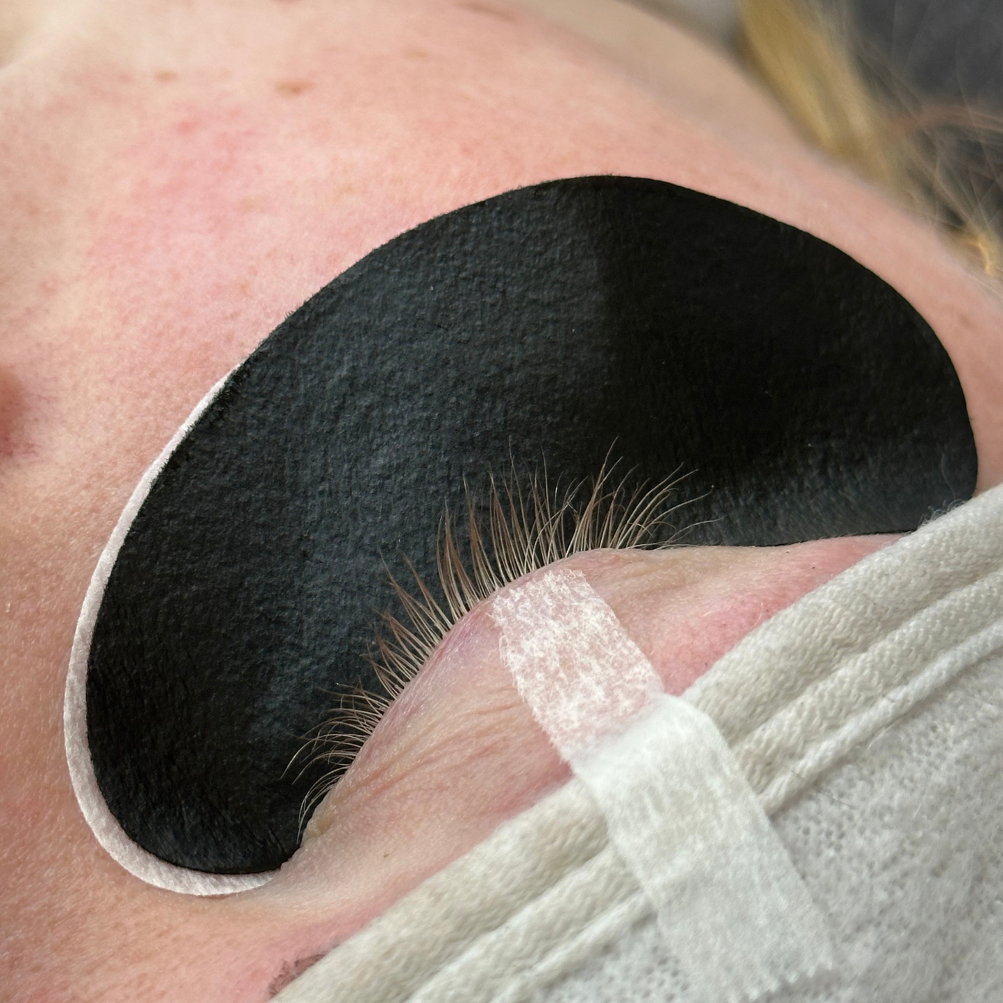 Black Eye Patches